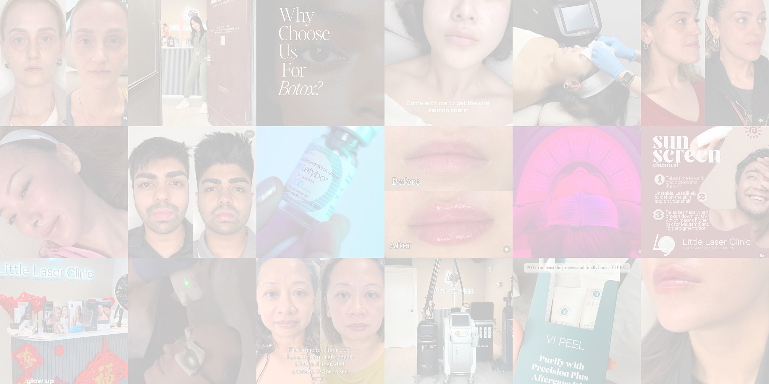 collage of social media posts from little laser clinic