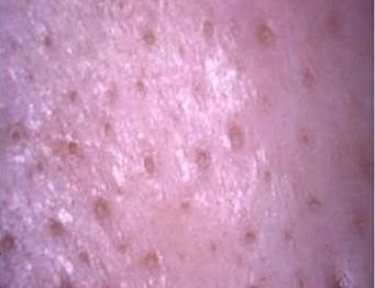 Close-up of skin texture and pores.