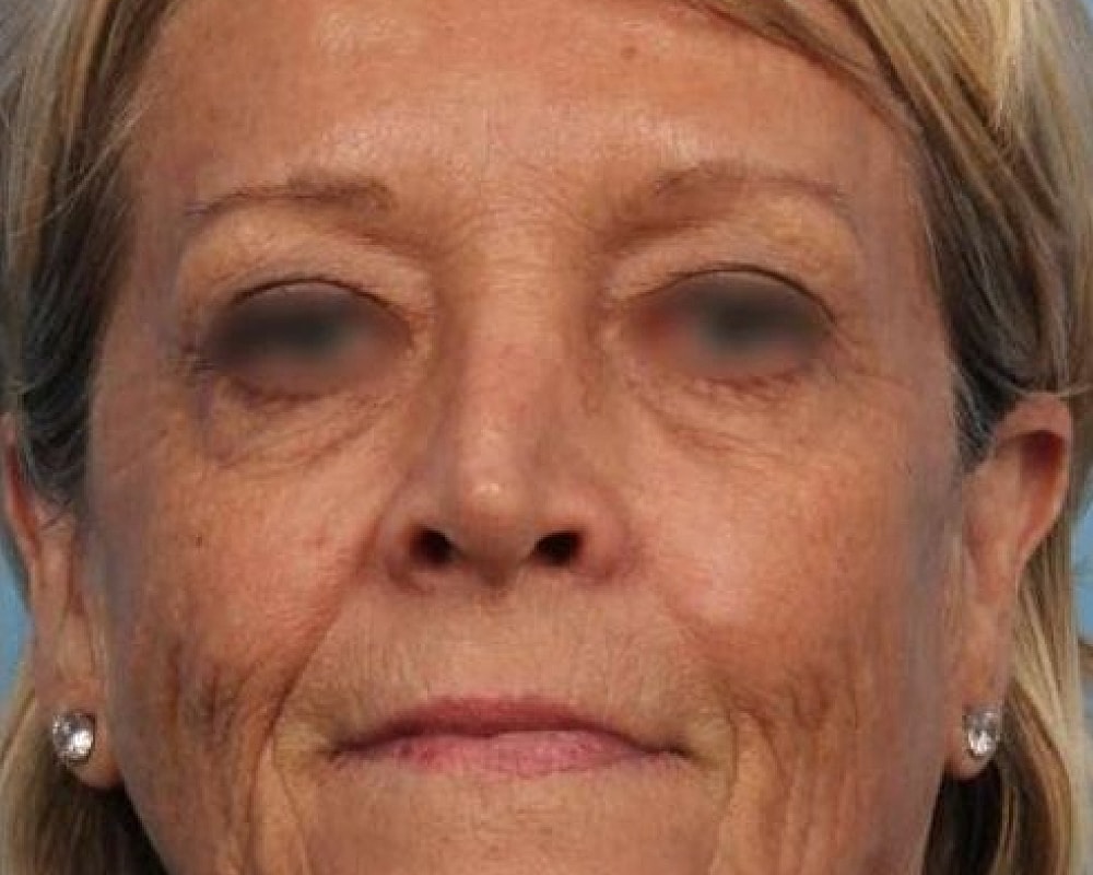 Close-up of a middle-aged woman’s face.