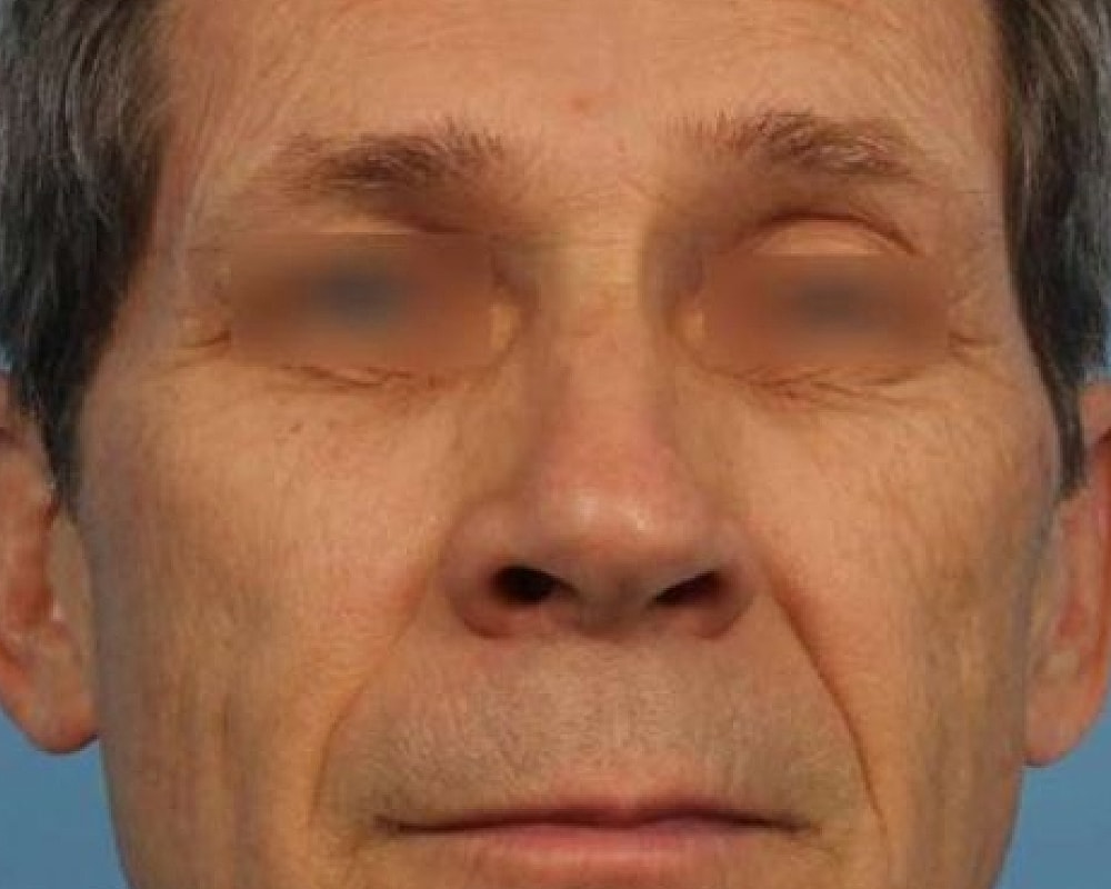 Man with a neutral expression and closed eyes.