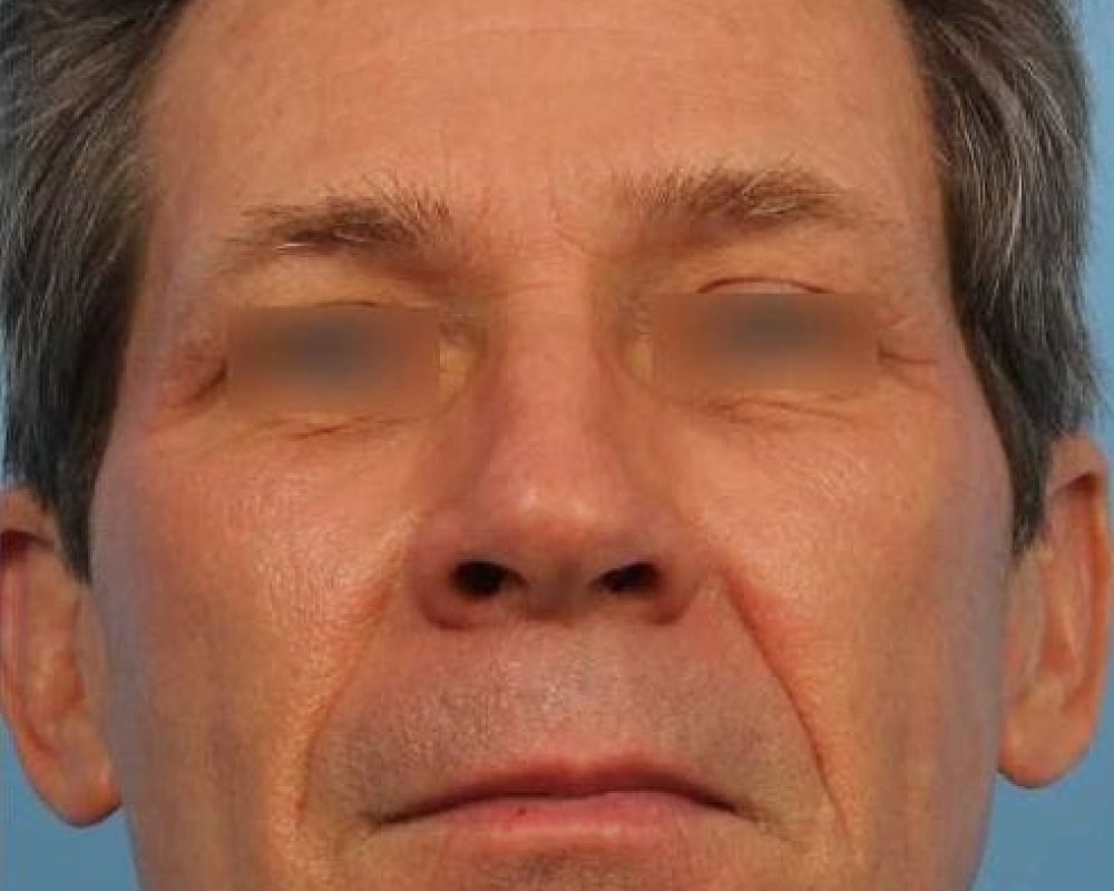 Close-up of a man's face with neutral expression.