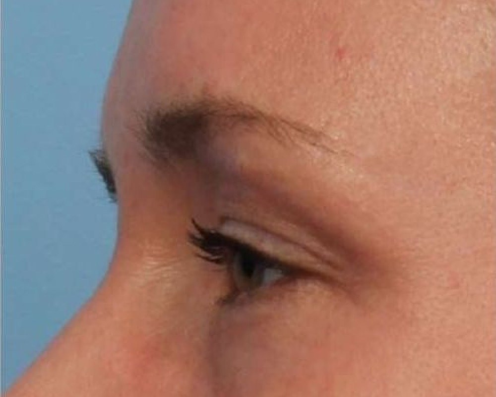 Close-up of a person's eye and brow.