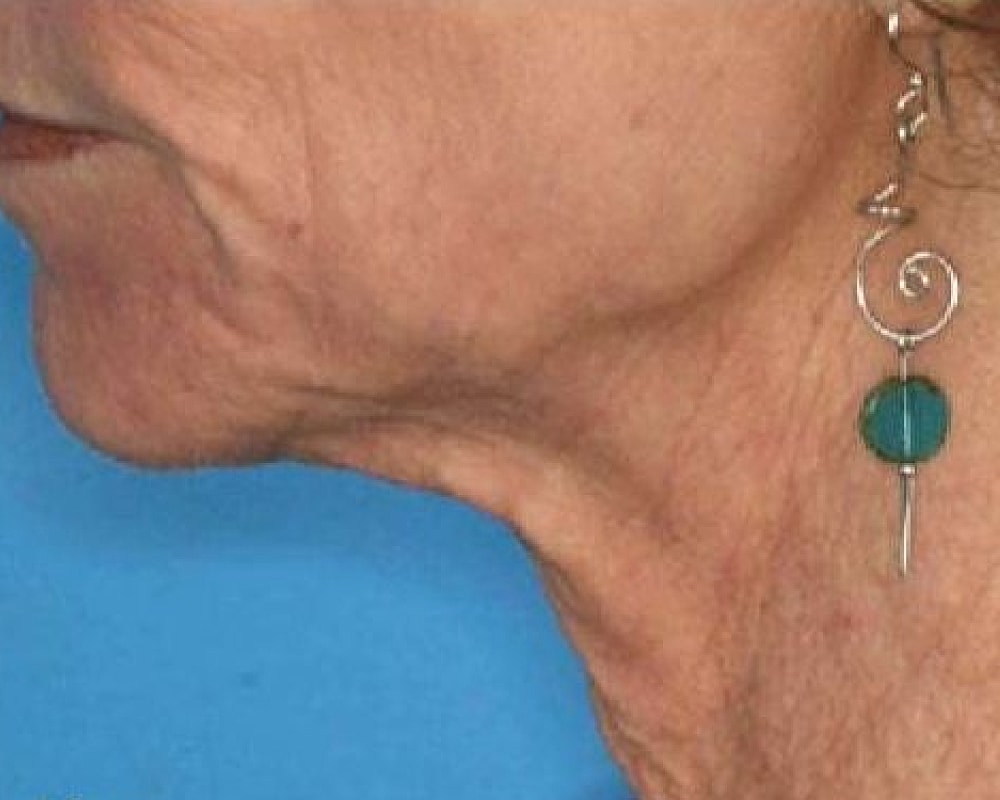 Side profile of a woman wearing an earring.