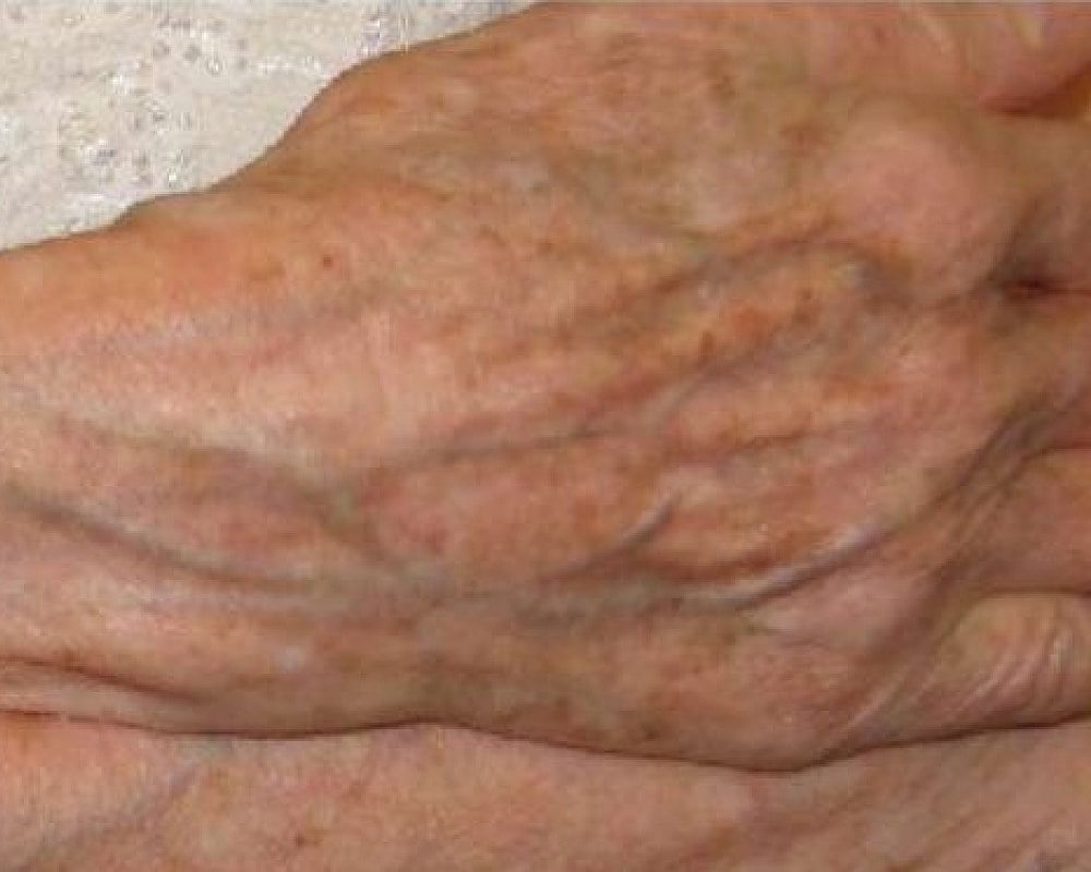 Close-up of an elderly person's hand.