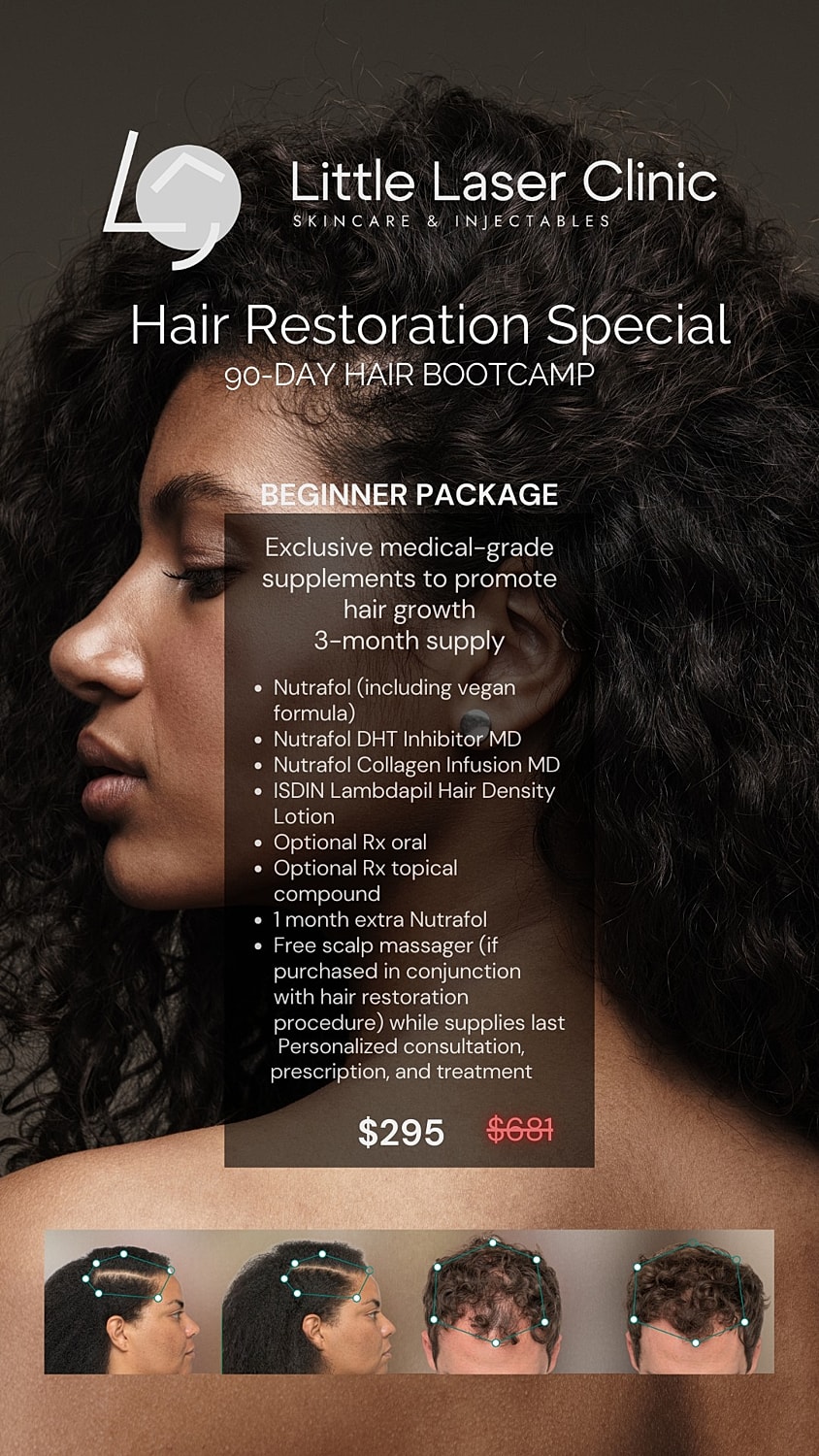 Hair restoration special promotion and pricing details