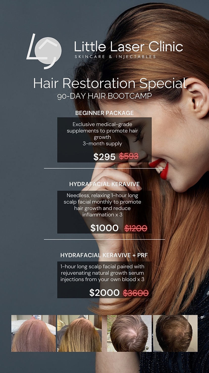 Hair restoration special offers and treatment packages.