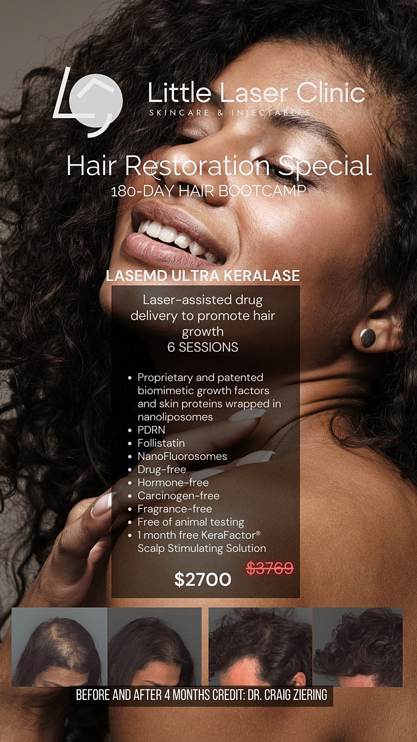 Hair restoration promotional graphic with before and after.